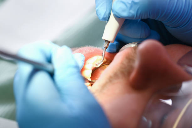 Best Knocked-Out Tooth Emergency  in North Hudson, WI